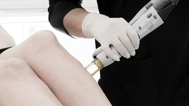 Smooth Solutions: Unveiling the Magic of Laser Hair Removal